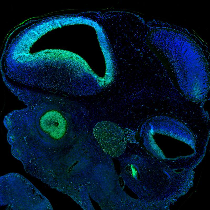 SOX2 Antibody (CL4716) - Azide and BSA Free Immunohistochemistry-Paraffin: SOX2 Antibody [NBP3-44099]