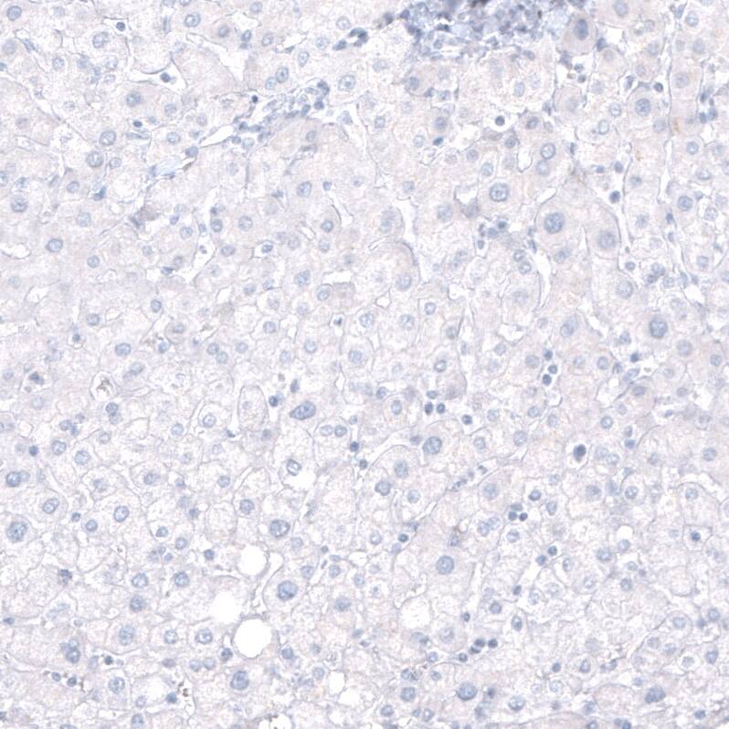 SOX2 Antibody (CL4716) - Azide and BSA Free Immunohistochemistry-Paraffin: SOX2 Antibody [NBP3-44099]