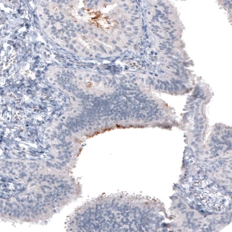CA125/MUC16 Antibody (CL2782) - Azide and BSA Free Immunohistochemistry-Paraffin: CA125/MUC16 Antibody [NBP3-44100]