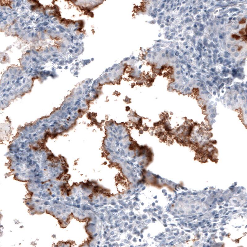 CA125/MUC16 Antibody (CL2782) - Azide and BSA Free Immunohistochemistry-Paraffin: CA125/MUC16 Antibody [NBP3-44100]