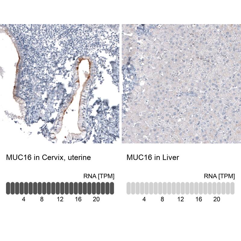 CA125/MUC16 Antibody (CL2782) - Azide and BSA Free Immunohistochemistry-Paraffin: CA125/MUC16 Antibody [NBP3-44100]