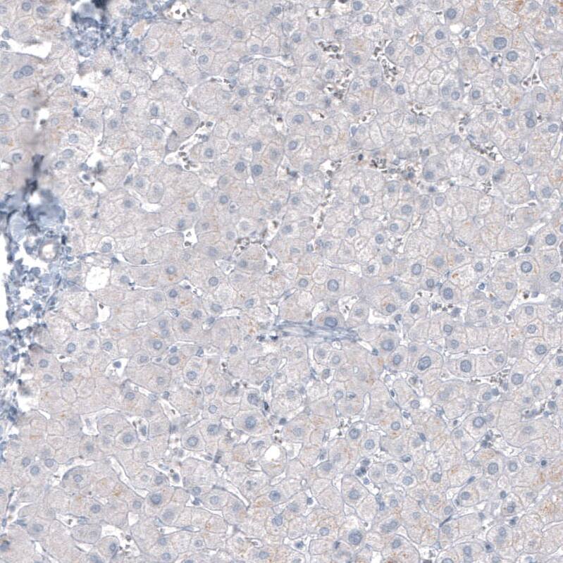CA125/MUC16 Antibody (CL2782) - Azide and BSA Free Immunohistochemistry-Paraffin: CA125/MUC16 Antibody [NBP3-44100]