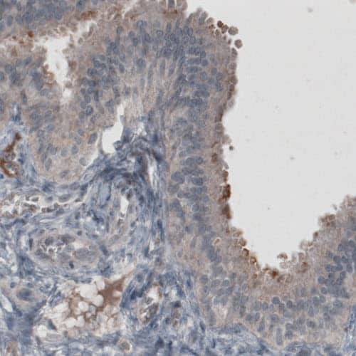 CA125/MUC16 Antibody (CL2783) - Azide and BSA Free Immunohistochemistry-Paraffin: CA125/MUC16 Antibody [NBP3-44101]