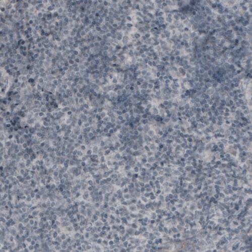 CA125/MUC16 Antibody (CL2783) - Azide and BSA Free Immunohistochemistry-Paraffin: CA125/MUC16 Antibody [NBP3-44101]