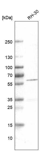 Desmin Antibody (CL4501) - Azide and BSA Free Western Blot: Desmin Antibody [NBP3-44102]