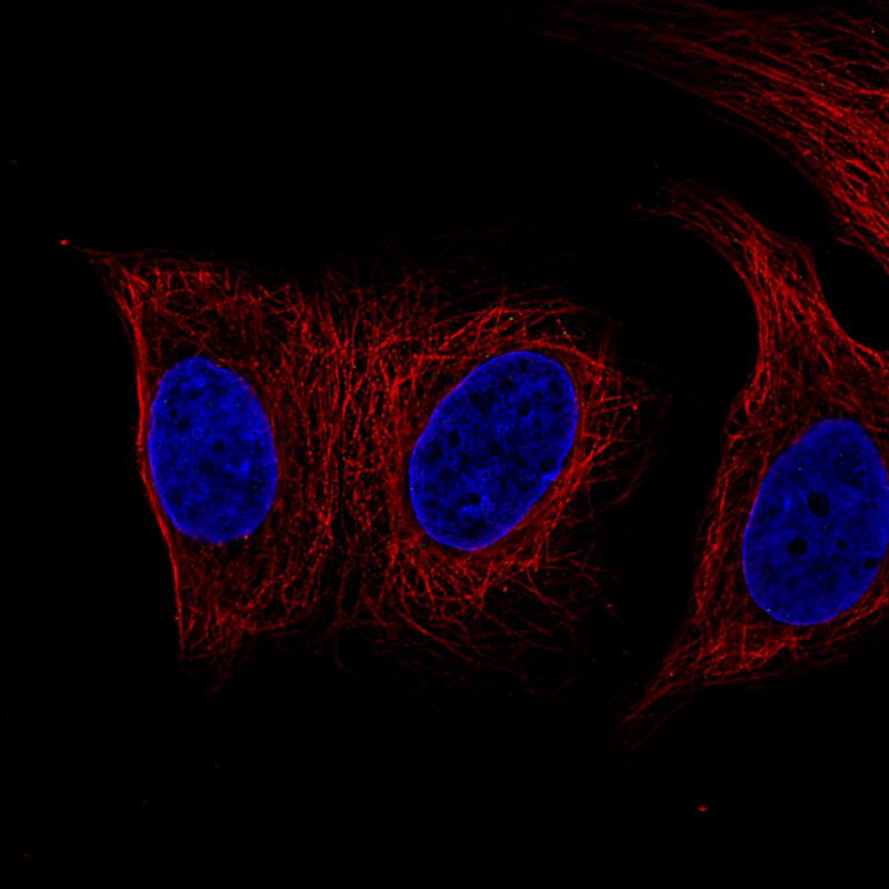 Desmin Antibody (CL4502) - Azide and BSA Free Immunocytochemistry/ Immunofluorescence: Desmin Antibody [NBP3-44103]