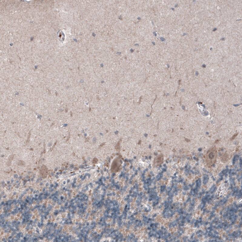 USP30 Antibody (CL4438) - Azide and BSA Free Immunohistochemistry-Paraffin: USP30 Antibody [NBP3-44104]