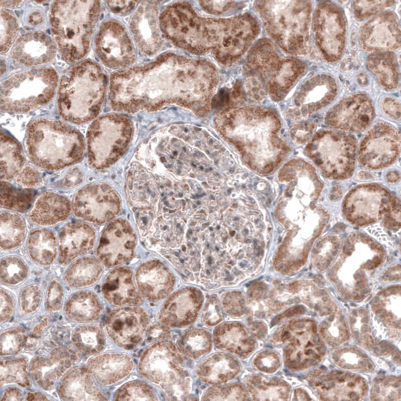 USP30 Antibody (CL4438) - Azide and BSA Free Immunohistochemistry-Paraffin: USP30 Antibody [NBP3-44104]