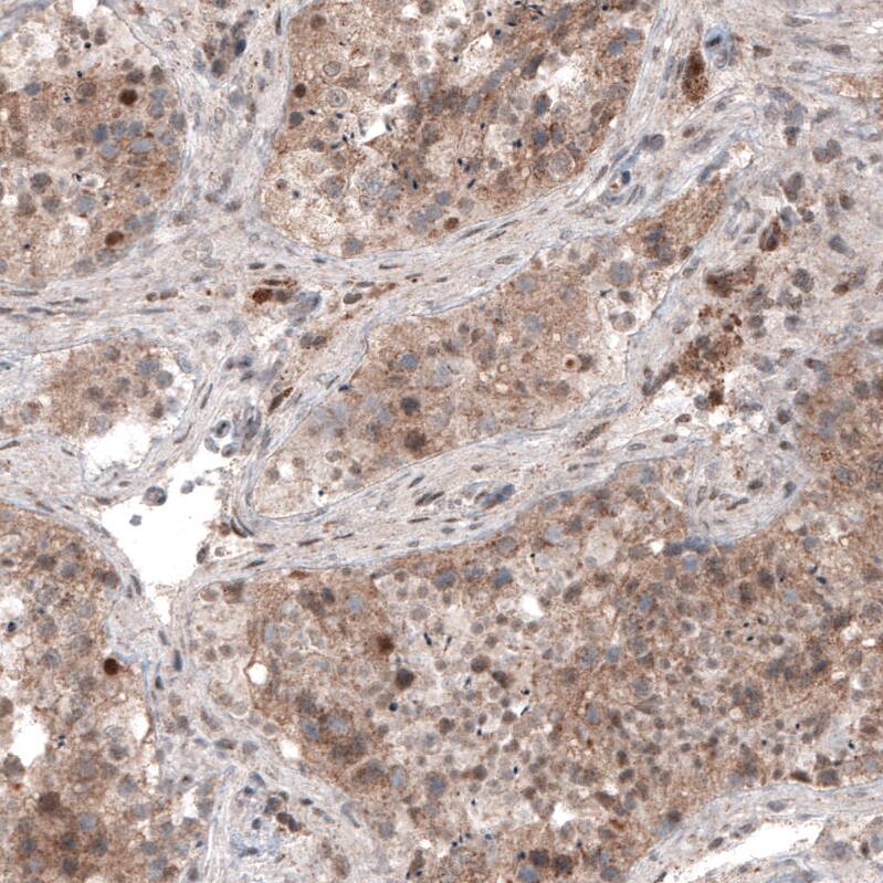 USP30 Antibody (CL4438) - Azide and BSA Free Immunohistochemistry-Paraffin: USP30 Antibody [NBP3-44104]