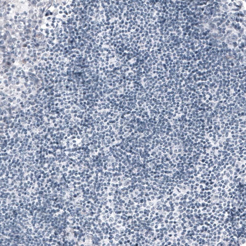 Ornithine Carbamoyltransferase Antibody (CL4045) - Azide and BSA Free Immunohistochemistry-Paraffin: Ornithine Carbamoyltransferase Antibody [NBP3-44105]