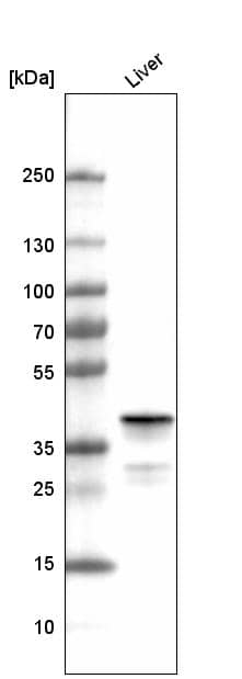 Ornithine Carbamoyltransferase Antibody (CL4045) - Azide and BSA Free Western Blot: Ornithine Carbamoyltransferase Antibody [NBP3-44105]