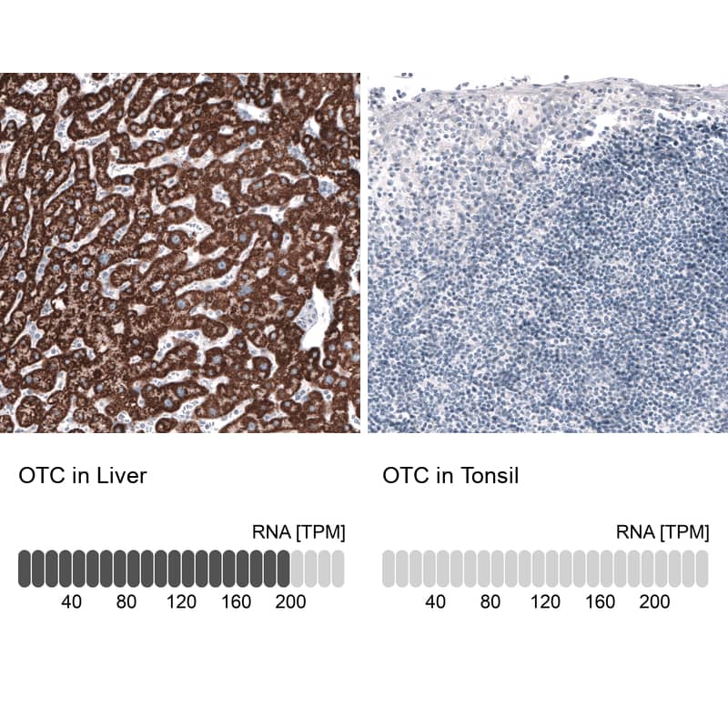 Ornithine Carbamoyltransferase Antibody (CL4046) - Azide and BSA Free Immunohistochemistry-Paraffin: Ornithine Carbamoyltransferase Antibody [NBP3-44106]