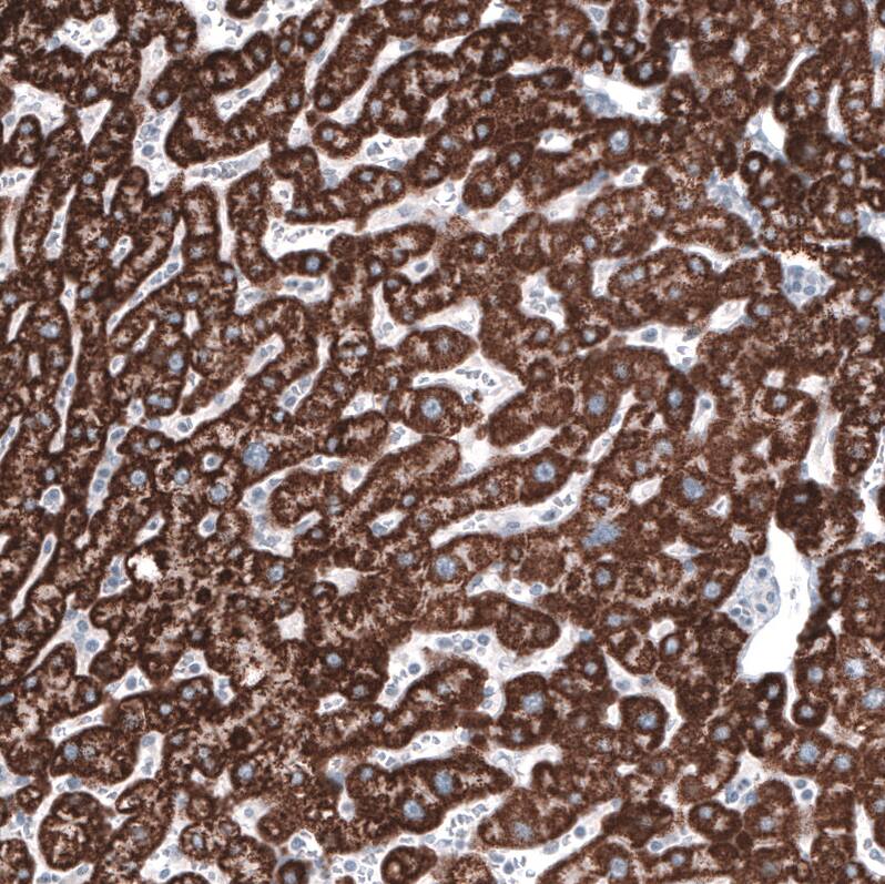 Ornithine Carbamoyltransferase Antibody (CL4046) - Azide and BSA Free Immunohistochemistry-Paraffin: Ornithine Carbamoyltransferase Antibody [NBP3-44106]