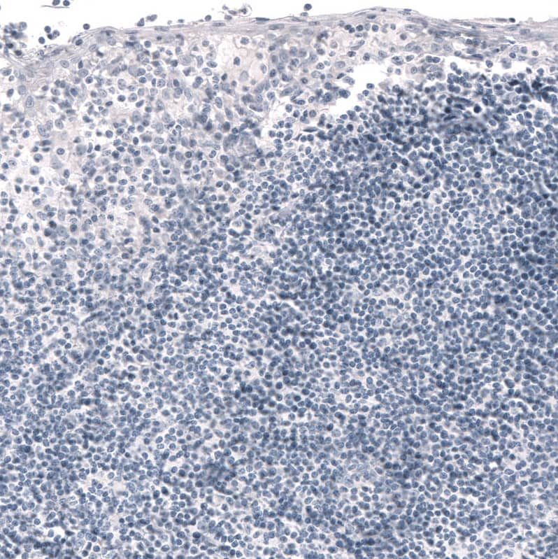 Ornithine Carbamoyltransferase Antibody (CL4046) - Azide and BSA Free Immunohistochemistry-Paraffin: Ornithine Carbamoyltransferase Antibody [NBP3-44106]