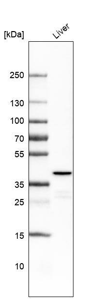 Ornithine Carbamoyltransferase Antibody (CL4049) - Azide and BSA Free Western Blot: Ornithine Carbamoyltransferase Antibody [NBP3-44107]