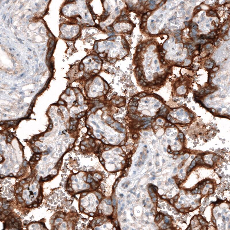 CLIP170 Antibody (CL4844) - Azide and BSA Free Immunohistochemistry-Paraffin: CLIP170 Antibody [NBP3-44108]