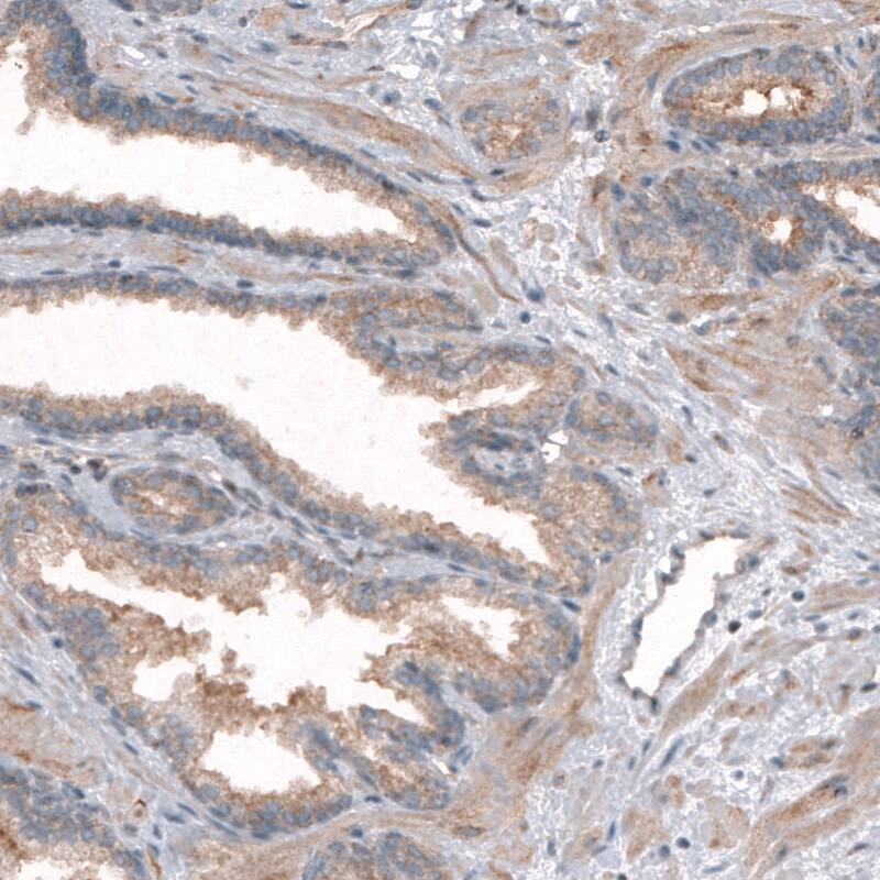 CLIP170 Antibody (CL4844) - Azide and BSA Free Immunohistochemistry-Paraffin: CLIP170 Antibody [NBP3-44108]