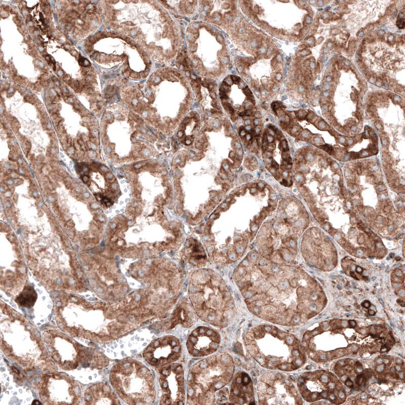 CLIP170 Antibody (CL4851) - Azide and BSA Free Immunohistochemistry-Paraffin: CLIP170 Antibody [NBP3-44109]