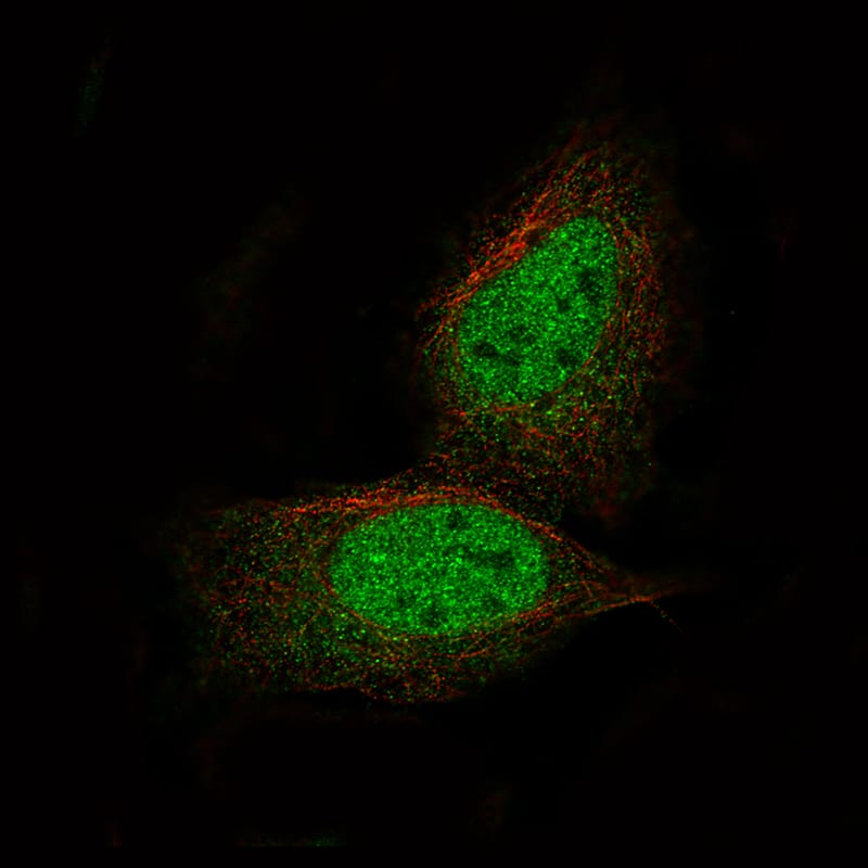 PRAME Antibody (CL5146) - Azide and BSA Free Immunocytochemistry/ Immunofluorescence: PRAME Antibody [NBP3-44110]