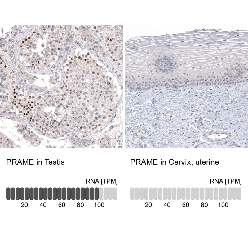 PRAME Antibody (CL5148) - Azide and BSA Free Immunohistochemistry-Paraffin: PRAME Antibody [NBP3-44111]