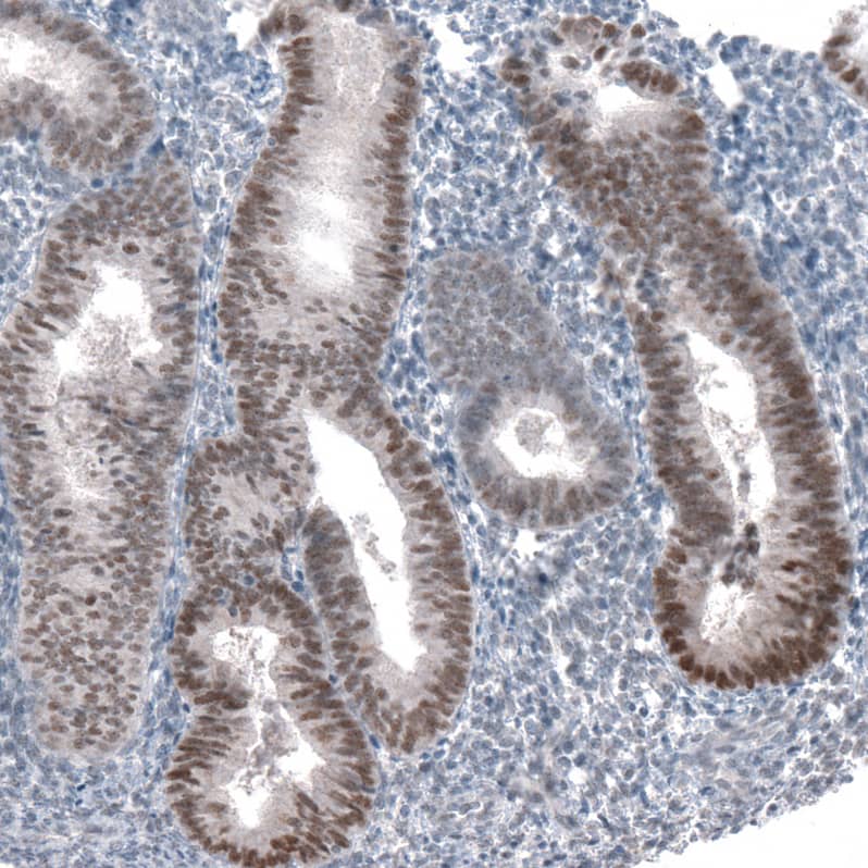PRAME Antibody (CL5148) - Azide and BSA Free Immunohistochemistry-Paraffin: PRAME Antibody [NBP3-44111]