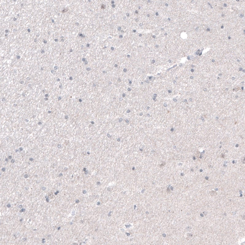 PRAME Antibody (CL5148) - Azide and BSA Free Immunohistochemistry-Paraffin: PRAME Antibody [NBP3-44111]
