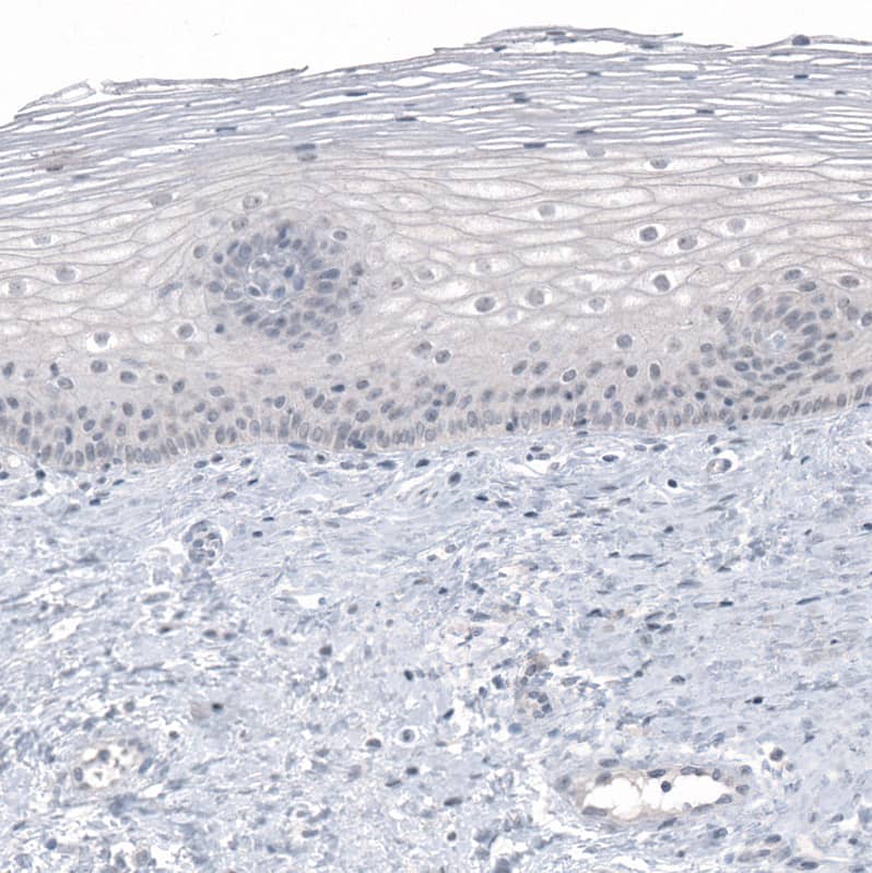 PRAME Antibody (CL5148) - Azide and BSA Free Immunohistochemistry-Paraffin: PRAME Antibody [NBP3-44111]