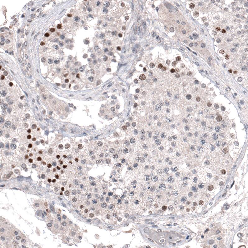 PRAME Antibody (CL5148) - Azide and BSA Free Immunohistochemistry-Paraffin: PRAME Antibody [NBP3-44111]