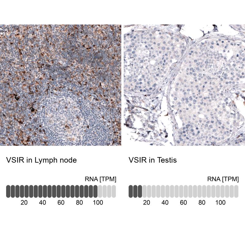 VISTA/B7-H5/PD-1H Antibody (CL3975) - Azide and BSA Free Immunohistochemistry-Paraffin: VISTA/B7-H5/PD-1H Antibody [NBP3-44112]