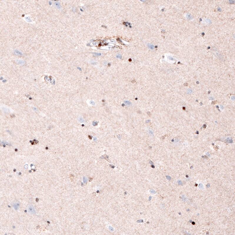 SOX10 Antibody (CL4455) - Azide and BSA Free Immunohistochemistry-Paraffin: SOX10 Antibody [NBP3-44116]