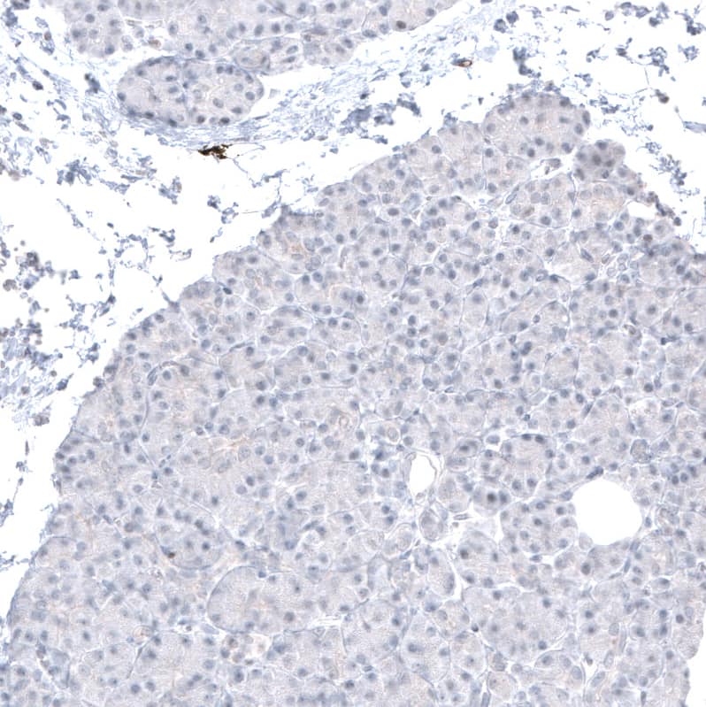 SOX10 Antibody (CL4455) - Azide and BSA Free Immunohistochemistry-Paraffin: SOX10 Antibody [NBP3-44116]