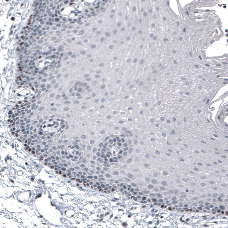 SOX10 Antibody (CL4455) - Azide and BSA Free Immunohistochemistry-Paraffin: SOX10 Antibody [NBP3-44116]