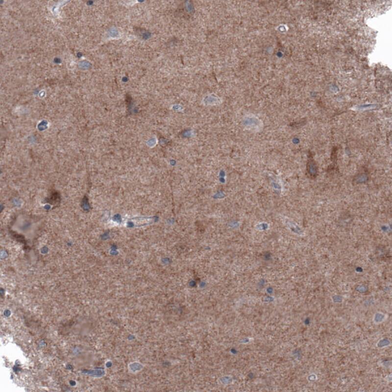 B-Raf Antibody (CL4003) - Azide and BSA Free Immunohistochemistry-Paraffin: B-Raf Antibody [NBP3-44117]