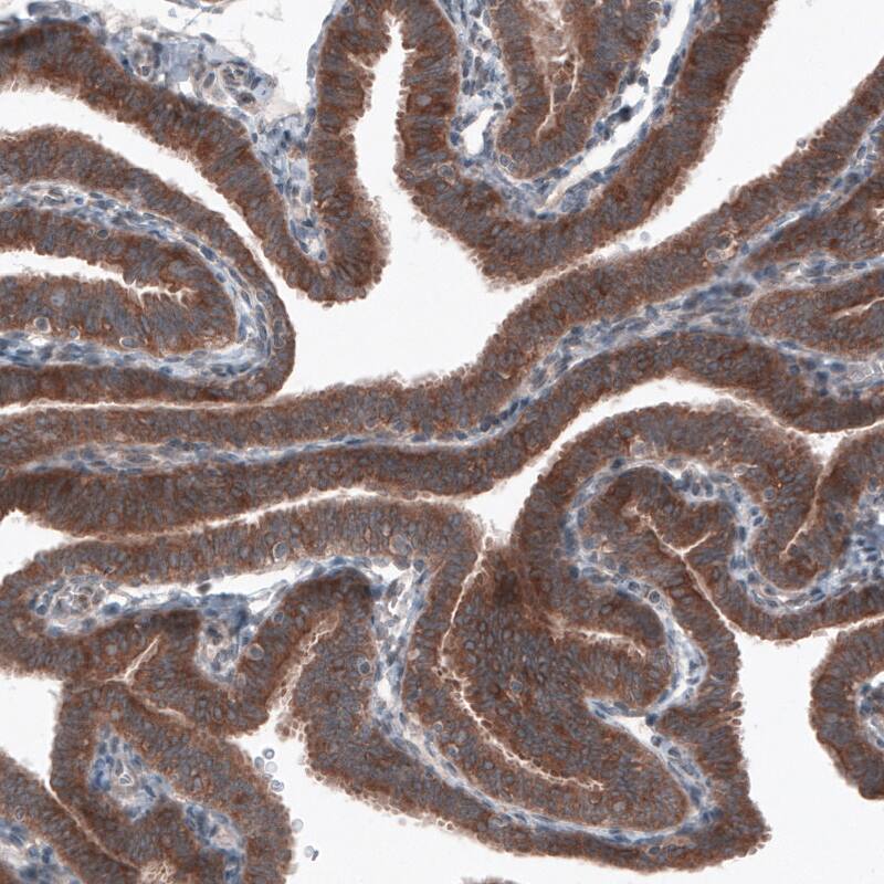 B-Raf Antibody (CL4003) - Azide and BSA Free Immunohistochemistry-Paraffin: B-Raf Antibody [NBP3-44117]