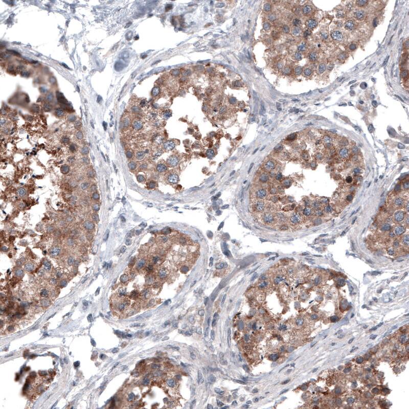 B-Raf Antibody (CL4003) - Azide and BSA Free Immunohistochemistry-Paraffin: B-Raf Antibody [NBP3-44117]