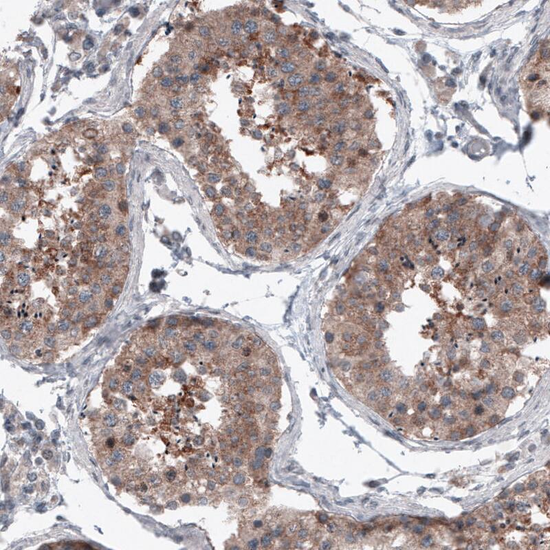 B-Raf Antibody (CL4004) - Azide and BSA Free Immunohistochemistry-Paraffin: B-Raf Antibody [NBP3-44118]