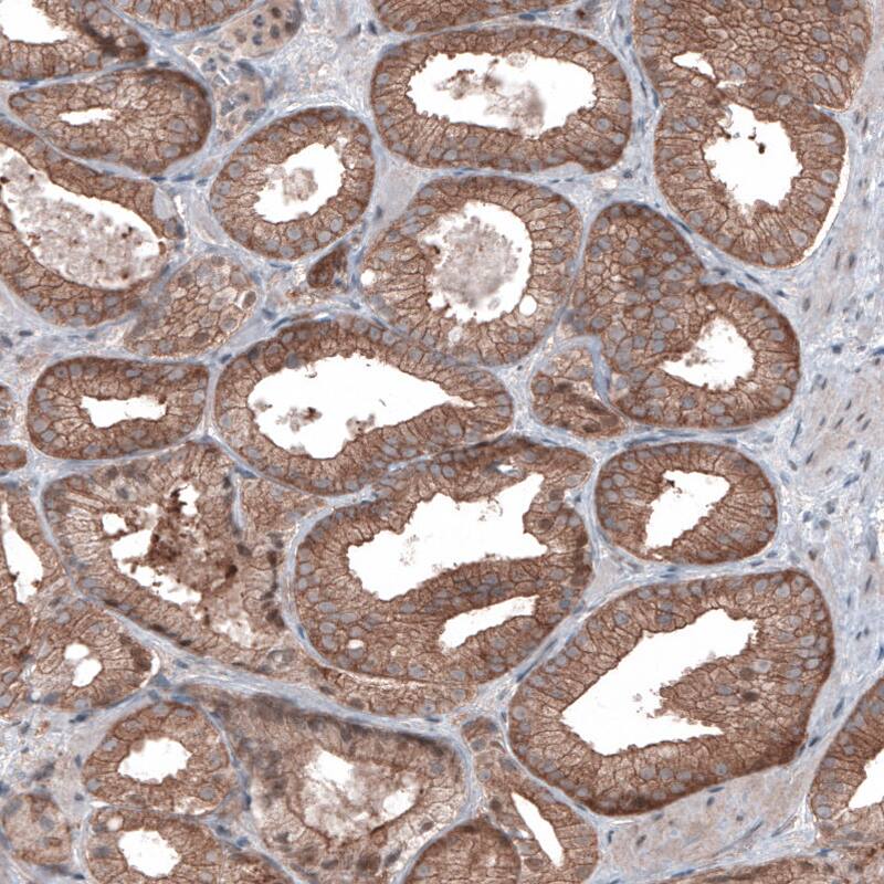 B-Raf Antibody (CL4004) - Azide and BSA Free Immunohistochemistry-Paraffin: B-Raf Antibody [NBP3-44118]