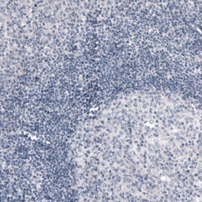 PRRT2 Antibody (CL4233) - Azide and BSA Free Immunohistochemistry-Paraffin: PRRT2 Antibody [NBP3-44119]