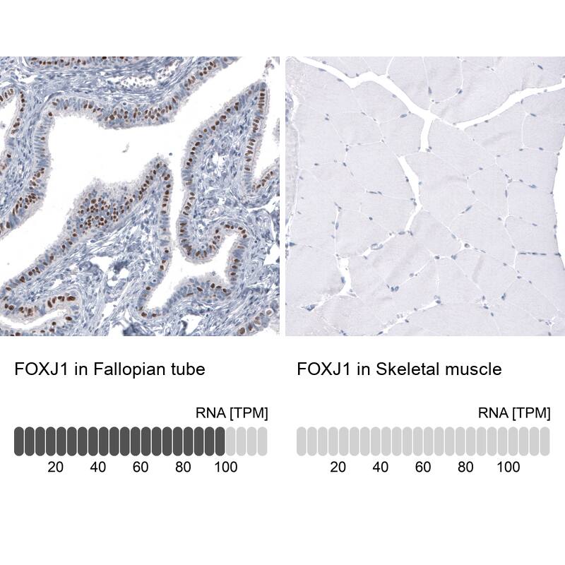 FoxJ1/HFH4 Antibody (CL3989) - Azide and BSA Free Immunohistochemistry-Paraffin: FoxJ1/HFH4 Antibody [NBP3-44120]