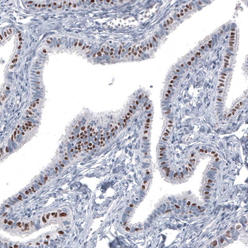 FoxJ1/HFH4 Antibody (CL3989) - Azide and BSA Free Immunohistochemistry-Paraffin: FoxJ1/HFH4 Antibody [NBP3-44120]