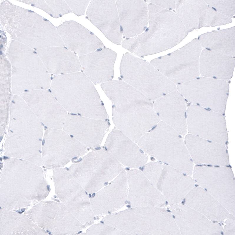 FoxJ1/HFH4 Antibody (CL3989) - Azide and BSA Free Immunohistochemistry-Paraffin: FoxJ1/HFH4 Antibody [NBP3-44120]