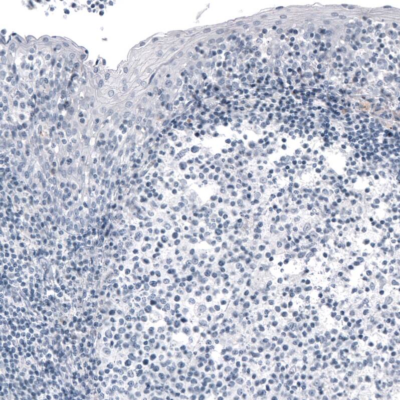 FoxJ1/HFH4 Antibody (CL3989) - Azide and BSA Free Immunohistochemistry-Paraffin: FoxJ1/HFH4 Antibody [NBP3-44120]