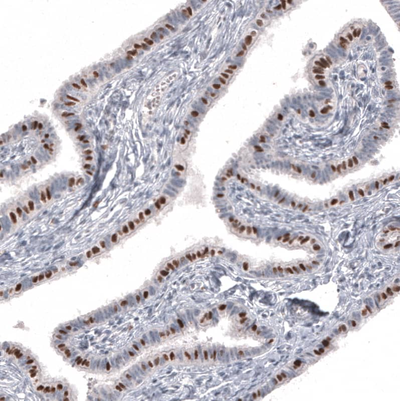 FoxJ1/HFH4 Antibody (CL3991) - Azide and BSA Free Immunohistochemistry-Paraffin: FoxJ1/HFH4 Antibody [NBP3-44121]