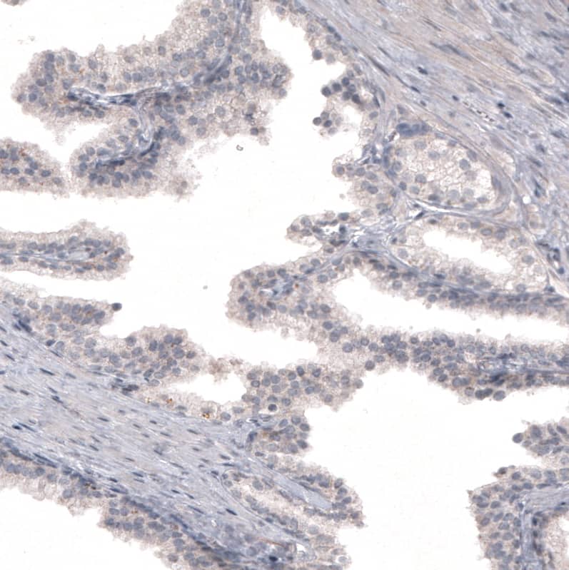 FoxJ1/HFH4 Antibody (CL3991) - Azide and BSA Free Immunohistochemistry-Paraffin: FoxJ1/HFH4 Antibody [NBP3-44121]