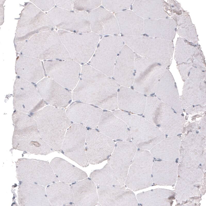 FoxJ1/HFH4 Antibody (CL3991) - Azide and BSA Free Immunohistochemistry-Paraffin: FoxJ1/HFH4 Antibody [NBP3-44121]