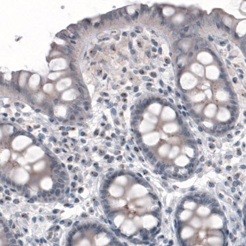 CEP350 Antibody (CL3423) - Azide and BSA Free Immunohistochemistry-Paraffin: CEP350 Antibody [NBP3-44123]
