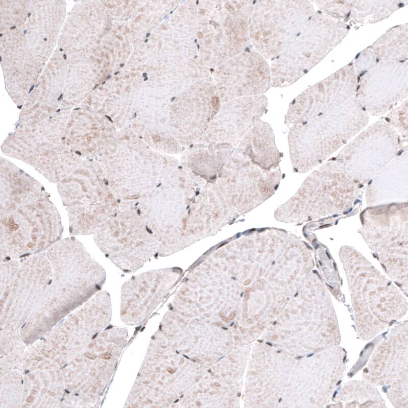 METTL14 Antibody (CL4252) - Azide and BSA Free Immunohistochemistry-Paraffin: METTL14 Antibody [NBP3-44125]