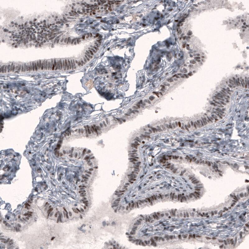 METTL14 Antibody (CL4254) - Azide and BSA Free Immunohistochemistry-Paraffin: METTL14 Antibody [NBP3-44126]