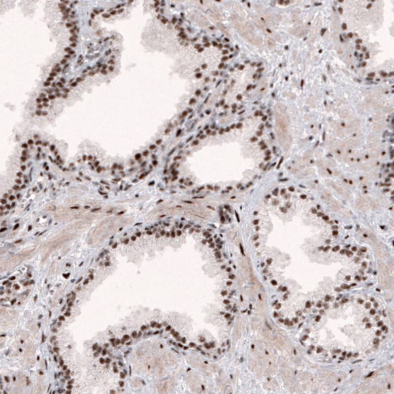 METTL14 Antibody (CL4254) - Azide and BSA Free Immunohistochemistry-Paraffin: METTL14 Antibody [NBP3-44126]