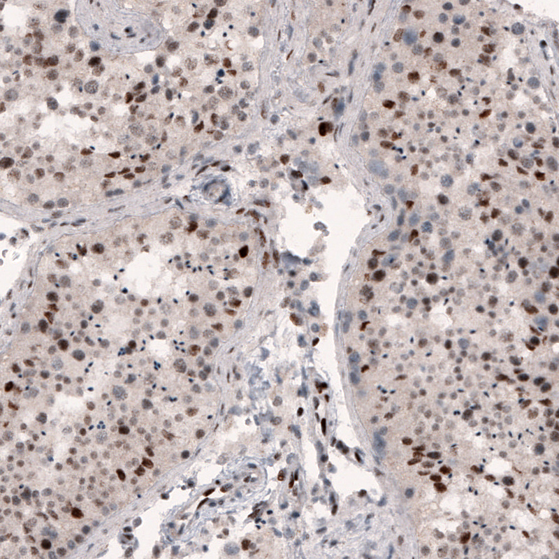 METTL14 Antibody (CL4254) - Azide and BSA Free Immunohistochemistry-Paraffin: METTL14 Antibody [NBP3-44126]